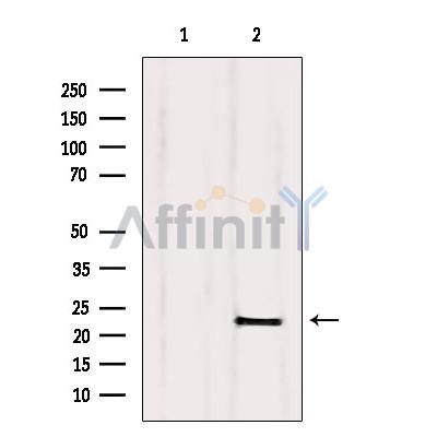 CNPY2/MSAP Antibody - Western blot analysis of extracts from Rat muscle, using CNPY2,MSAP Antibody.