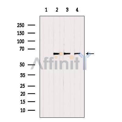 ETFDH Antibody - Western blot analysis of extracts from various samples, using ETFDH Antibody.