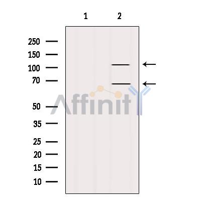 FAM65B Antibody - Western blot analysis of extracts from Mouse lung, using FAM65B Antibody.