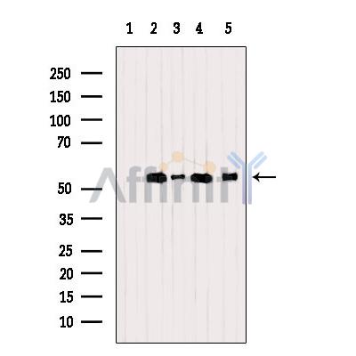 PDIA6 Antibody - Western blot analysis of extracts from various samples, using PDIA6 Antibody.