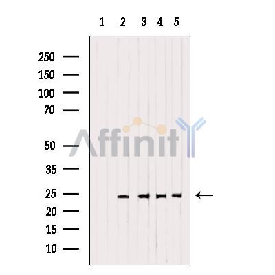RAB14 Antibody - Western blot analysis of extracts from various samples, using RAB14 Antibody.