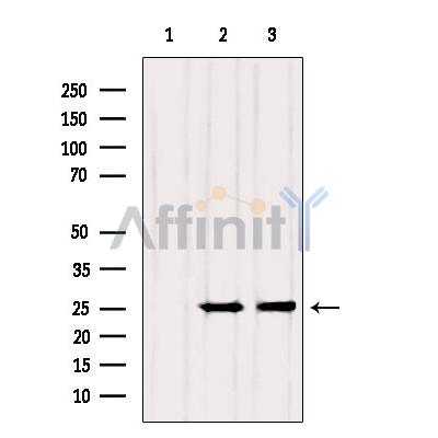 Rab3A Antibody - Western blot analysis of extracts from various samples, using RAB3A Antibody.