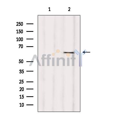 RIC8B Antibody - Western blot analysis of extracts from various samples, using RIC8B Antibody.