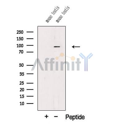 PIWL1 Antibody - Western blot analysis of extracts from Mouse testis tissue, using PIWL1 Antibody.