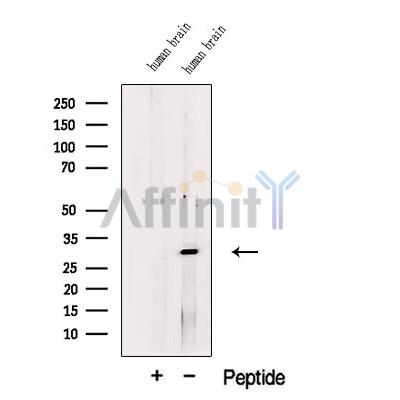 TM158 Antibody - Western blot analysis of extracts from Human brain tissue, using TM158 Antibody.