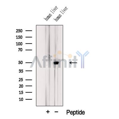 KDM8 Antibody - Western blot analysis of extracts from Human liver tissue, using KDM8 Antibody.
