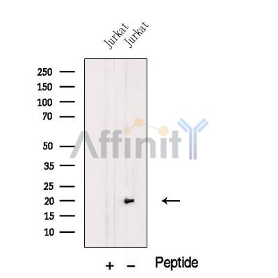 MFAP5 Antibody - Western blot analysis of extracts from Jurkat cells, using MFAP5 Antibody.