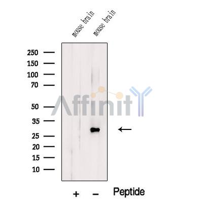 TMEM9 Antibody - Western blot analysis of extracts from Mouse brain tissue, using TMEM9 Antibody.