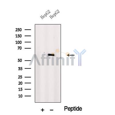 PRAME Antibody - Western blot analysis of extracts from HepG2 cells, using PRAME Antibody.