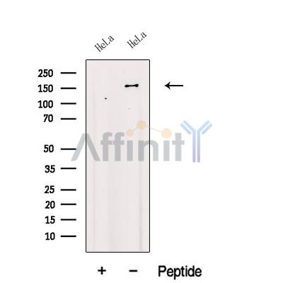 KDM2B Antibody - Western blot analysis of extracts from HeLa cells, using KDM2B Antibody.