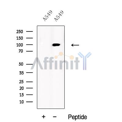 USP5 Antibody - Western blot analysis of extracts from A549 cells, using UBP5 Antibody.