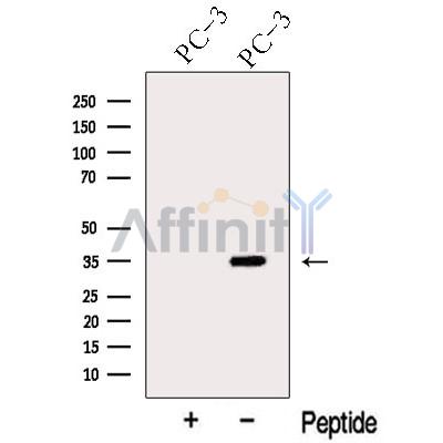 ARPC2 Antibody - Western blot analysis of extracts from PC-3 cells, using ARPC2 Antibody.