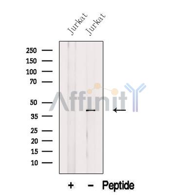 AUP1 Antibody - Western blot analysis of extracts from Jurkat cells, using AUP1 Antibody.