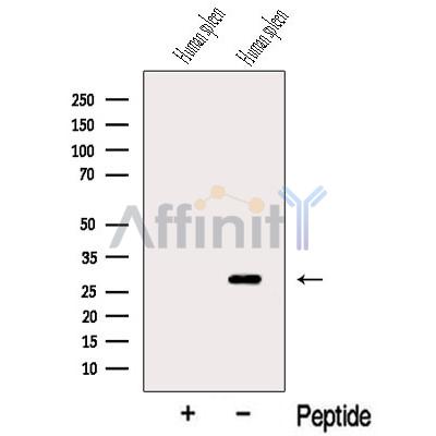C18orf55 Antibody - Western blot analysis of extracts from Human spleen tissue, using C18orf55 Antibody.