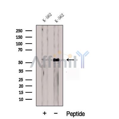 CDR2L Antibody - Western blot analysis of extracts from K-562 cells, using CDR2L Antibody.