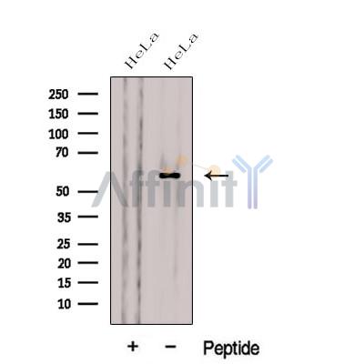 CES3 Antibody - Western blot analysis of extracts from HeLa cells, using CES3 Antibody.
