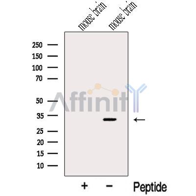 CHMP2B Antibody - Western blot analysis of extracts from Mouse brain tissue , using CHMP2B Antibody.
