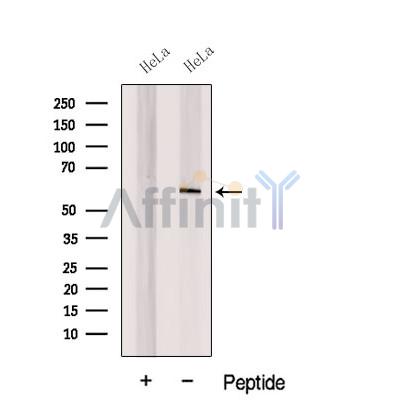CORO1C Antibody - Western blot analysis of extracts from HeLa cells , using CORO1C Antibody.