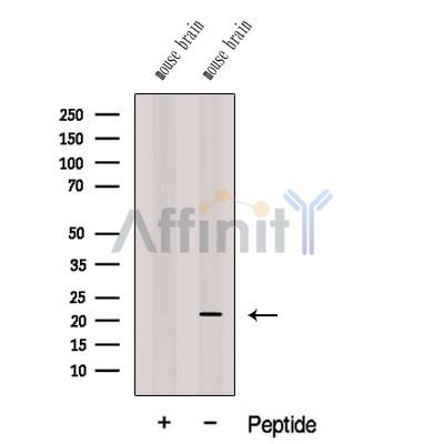 CPLX3 Antibody - Western blot analysis of extracts from Mouse brain tissue, using CPLX3 Antibody.