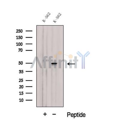CUGBP2 Antibody - Western blot analysis of extracts from K-562 cells, using CUGBP2 Antibody.