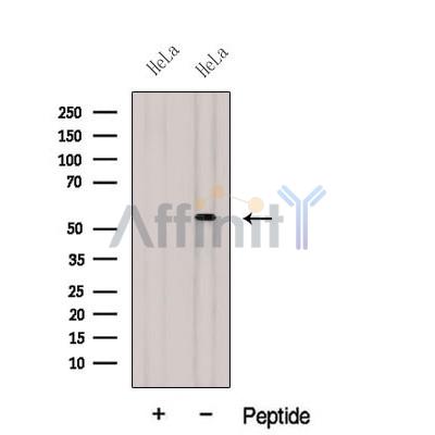 DBNL Antibody - Western blot analysis of extracts from HeLa cells, using DBNL Antibody.