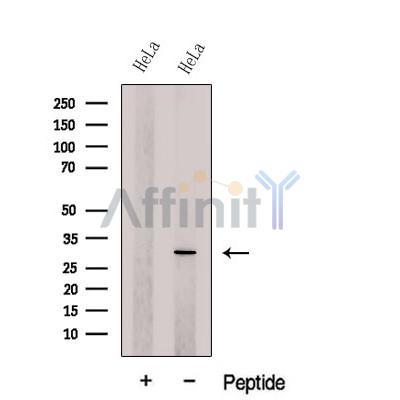 DCUN1D5 Antibody - Western blot analysis of extracts from HeLa cells, using DCUN1D5 Antibody.