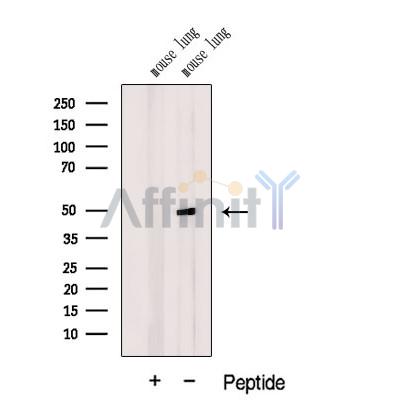 DMKN Antibody - Western blot analysis of extracts from Mouse lung tissue, using DMKN Antibody.