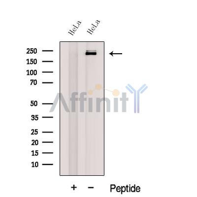 FcRn Antibody - Western blot analysis of extracts from HeLa cells, using FcRn-Specific Antibody.