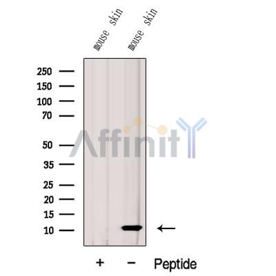 G0S2 Antibody - Western blot analysis of extracts from Mouse  skin tissue, using G0S2 Antibody.