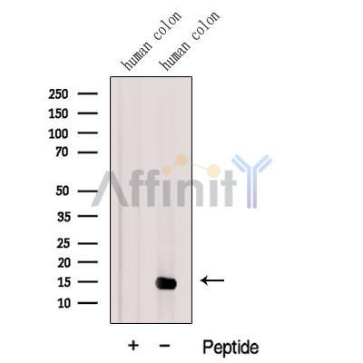 Galectin2 Antibody - Western blot analysis of extracts from Human colon tissue, using Galectin2 Antibody.