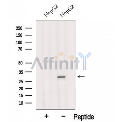 GSTT2B Antibody - Western blot analysis of extracts from HepG2 cells, using GSTT2B Antibody.