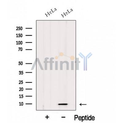 HIGD1A Antibody - Western blot analysis of extracts from HeLa cells, using HIGD1A Antibody.
