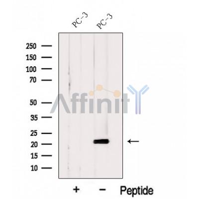 Hikeshi Antibody - Western blot analysis of extracts from PC-3 cells, using Hikeshi Antibody.
