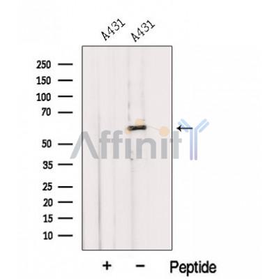 IMPDH1 Antibody - Western blot analysis of extracts from A431 cells, using IMPDH1 Antibody.