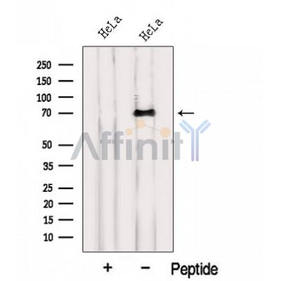 INTS10 Antibody - Western blot analysis of extracts from HeLa cells, using INTS10 Antibody.