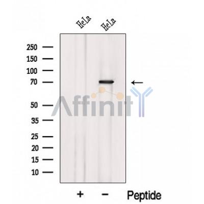 KATNB1 Antibody - Western blot analysis of extracts from HeLa cells, using KATNB1 Antibody.