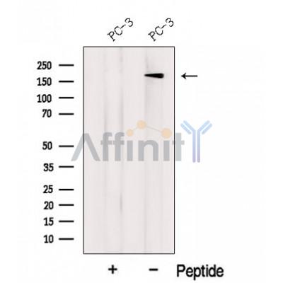 LTBP2 Antibody - Western blot analysis of extracts from PC-3 cells, using LTBP2 Antibody.