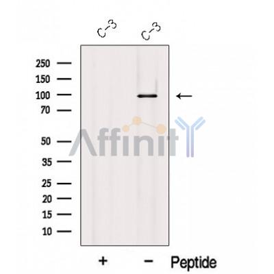 MCC Antibody - Western blot analysis of extracts from C-3 cells, using MCC Antibody.