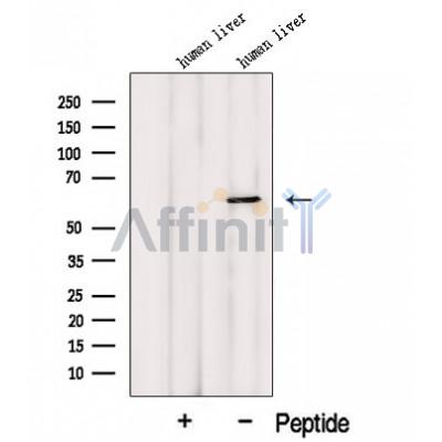 MCCC2 Antibody - Western blot analysis of extracts from Human liver tissue, using MCCC2 Antibody.