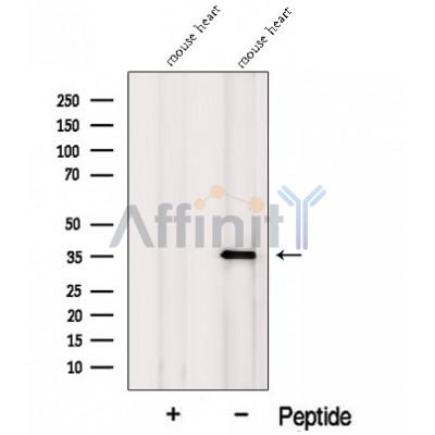 MFAP4 Antibody - Western blot analysis of extracts from Mouse heart tissue, using MFAP4 Antibody.