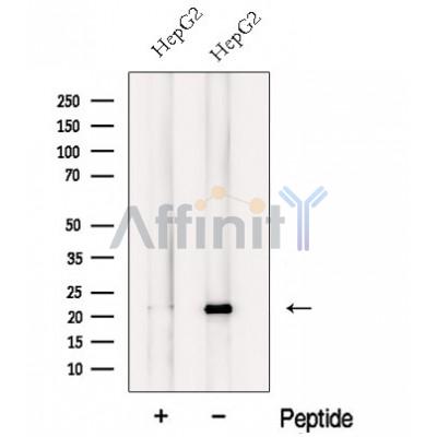 NCS1 Antibody - Western blot analysis of extracts from HepG2 cells, using NCS1 Antibody.