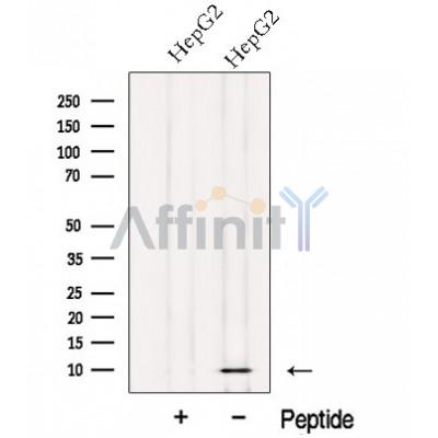 NDUFV3 Antibody - Western blot analysis of extracts from HepG2 cells, using NDUFV3 Antibody.