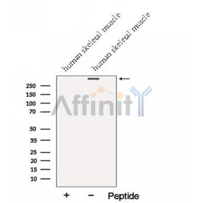 NEB Antibody - Western blot analysis of extracts from Human skeletal muscle  tissue, using NEB-Specific Antibody.