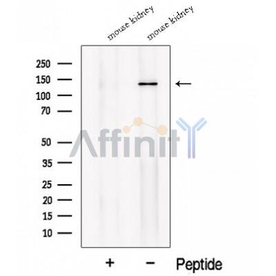 NKCC2 Antibody - Western blot analysis of extracts from Mouse kidney tissue, using NKCC2 Antibody.