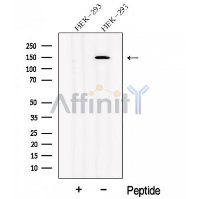 NPHP3 Antibody - Western blot analysis of extracts from HEK-293 cells, using NPHP3 Antibody.
