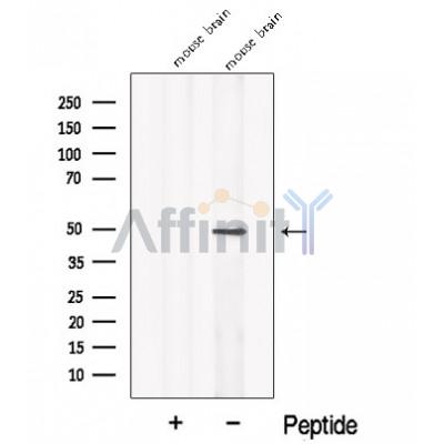 NPTX2 Antibody - Western blot analysis of extracts from Mouse brain tissue, using NPTX2 Antibody.