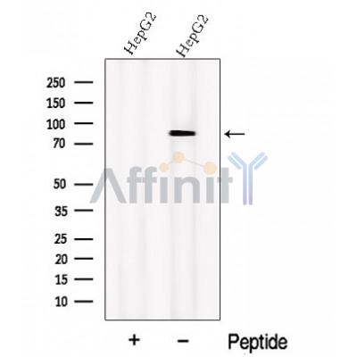 P5CS Antibody - Western blot analysis of extracts from HepG2 cells, using P5CS Antibody.