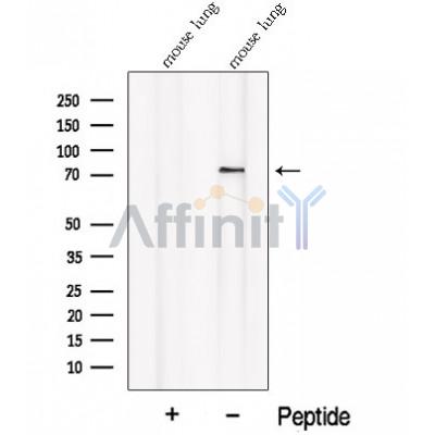 PALMD Antibody - Western blot analysis of extracts from Mouse lung tissue, using PALMD Antibody.