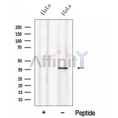 PIH1D1 Antibody - Western blot analysis of extracts from HeLa cells, using PIH1D1 Antibody.