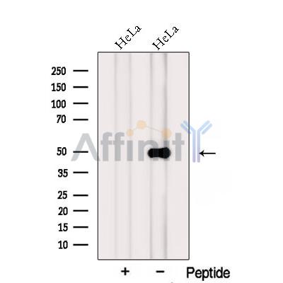 PTPRR Antibody - Western blot analysis of extracts from HeLa cells, using PTPRR Antibody.